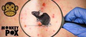 Varíola dos macacos, monkeypox